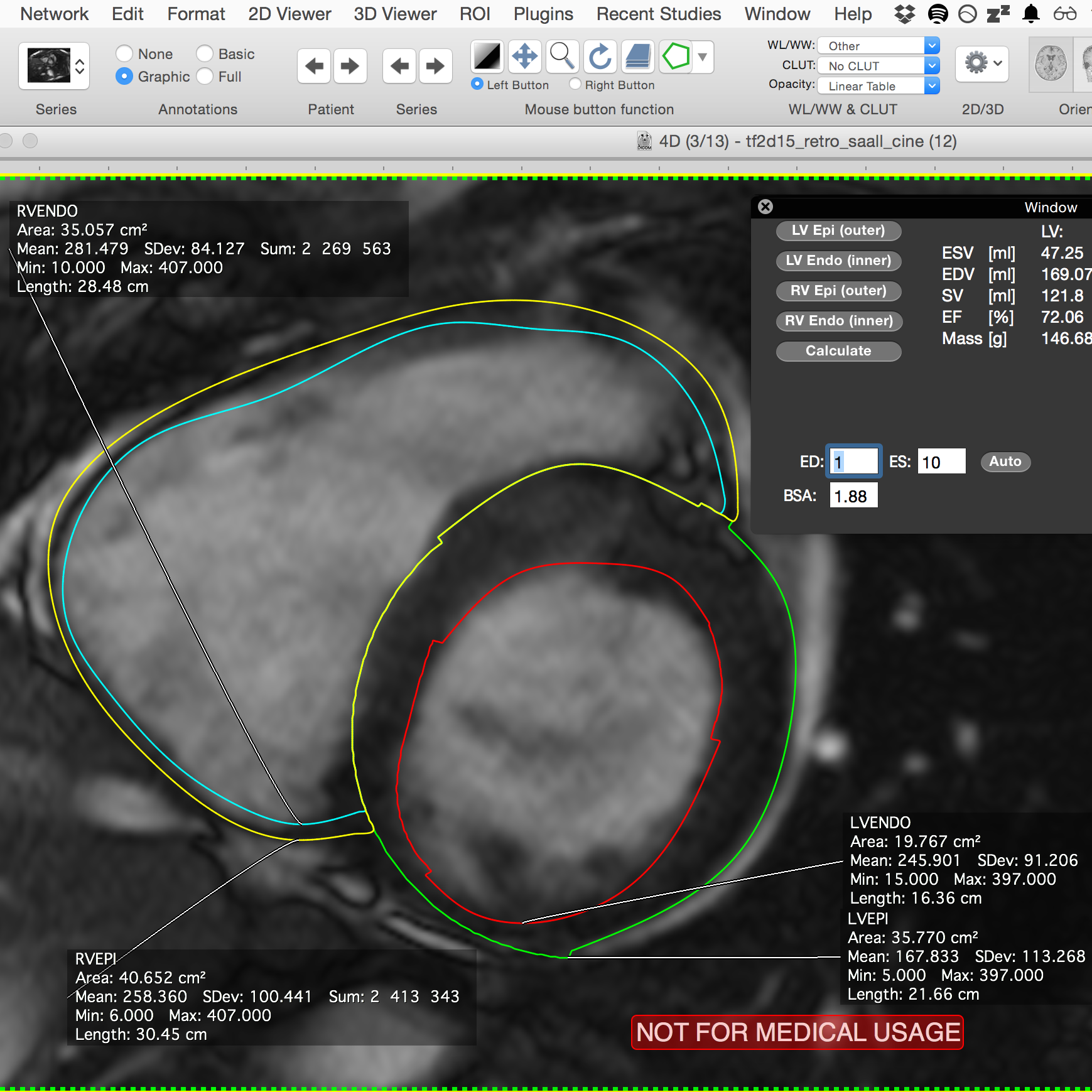 osirix lite draw roi